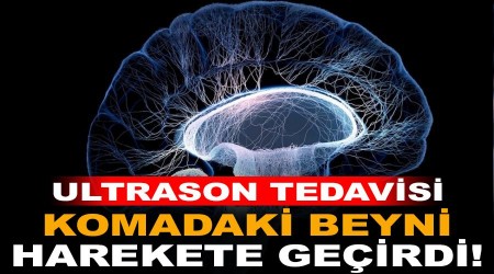 Ultrason tedavisi komadaki beyni harekete geçirdi!