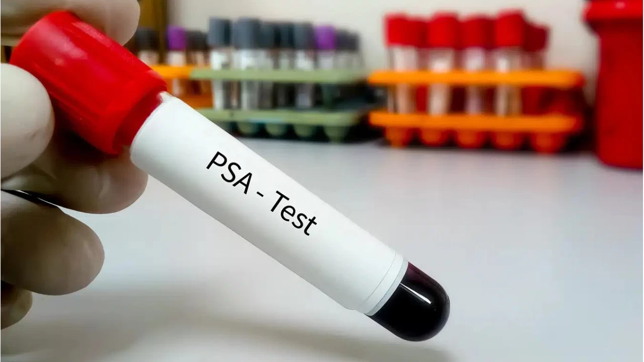 '50 ya��ndan sonra PSA testi �nemli'