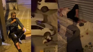 Adana'da evden kaçan pitbull, sahibini ve 2 kişiyi yaraladı