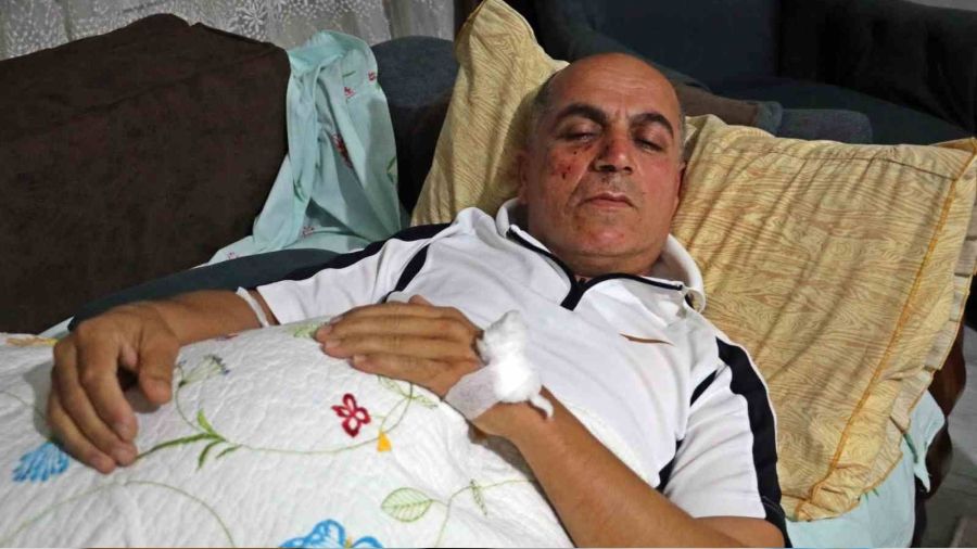 Antalya'da taksi şoförünü öldüresiye dövdüler