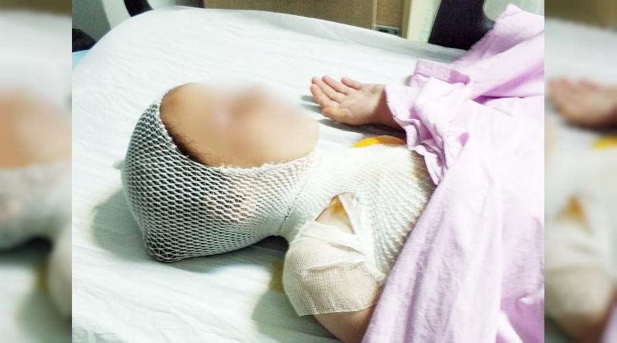 Kaynar s�t �ocu�u hastanelik etti 