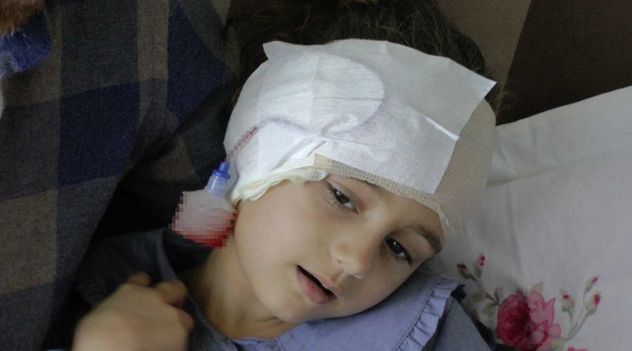 O köpek, çocuğun kulağını kopardı