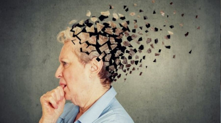'Alzheimer çalışmaları yanlış yönlendirildi'