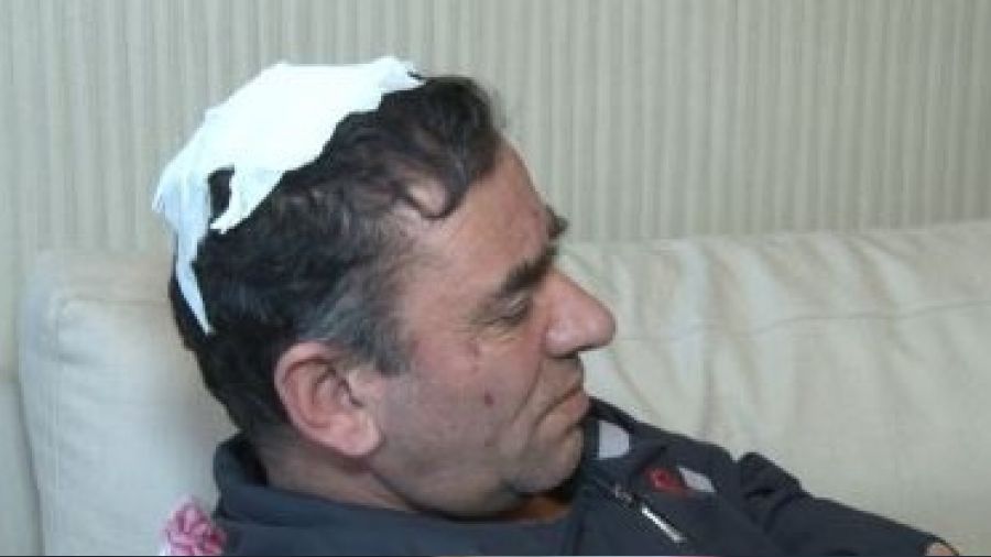 Ankara'da bir şahıs amcasının kafa derisini yüzdü