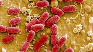 Antibiyotik Çağının Sonu mu? Dirençli Enfeksiyonlar Kapımızda