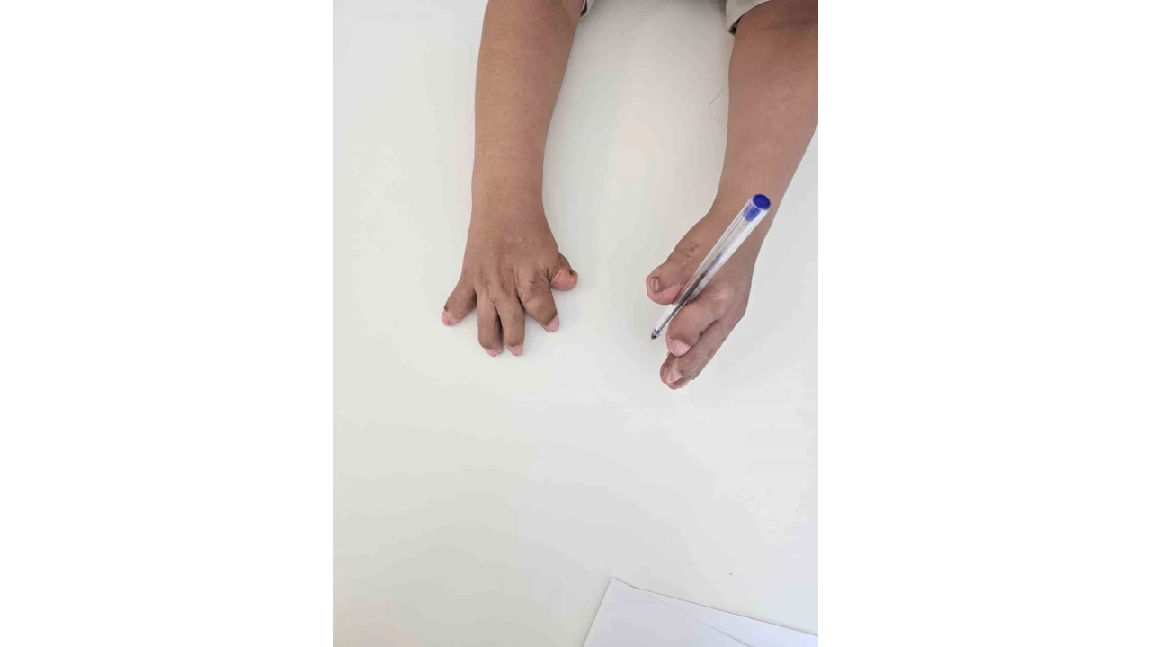 Doktorlar�n ismini yeni duydu�u rahats�zl�k Eski�ehir'de tedavi edildi, 10 parma�� a��ld�