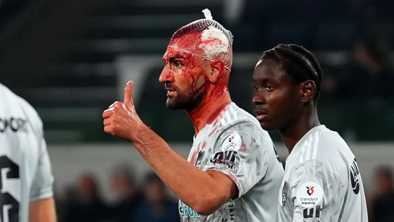 'Serdar Dursun'un kafasındaki yarıktan kemiği görünüyordu'