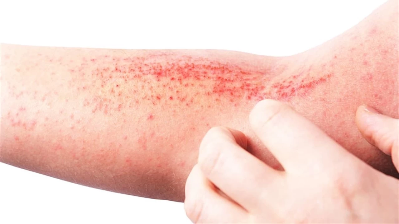 Sık sık cilt sorunu yaşıyorsanız dermatologla mutlaka görüşün