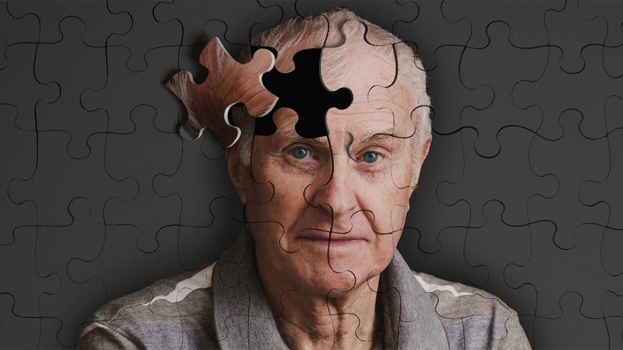 Uçuk Virüsü Alzheimer Hastalığı Riskini Artırabilir
