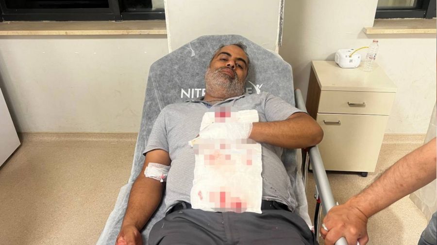 Yorgun mermi bah�ede otururken isabet etti