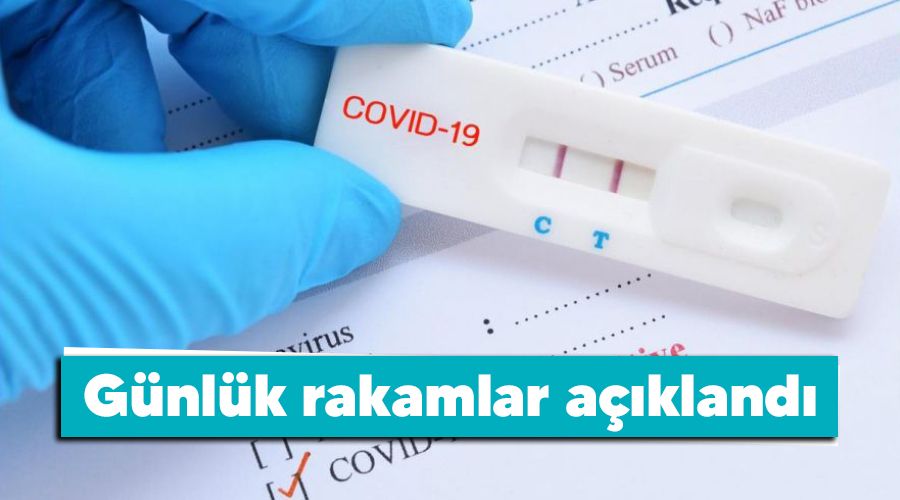 50 bin 678 pozitif vaka, 237 vefat