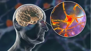 Beyin yalanmasn durdurmak mmkn m?