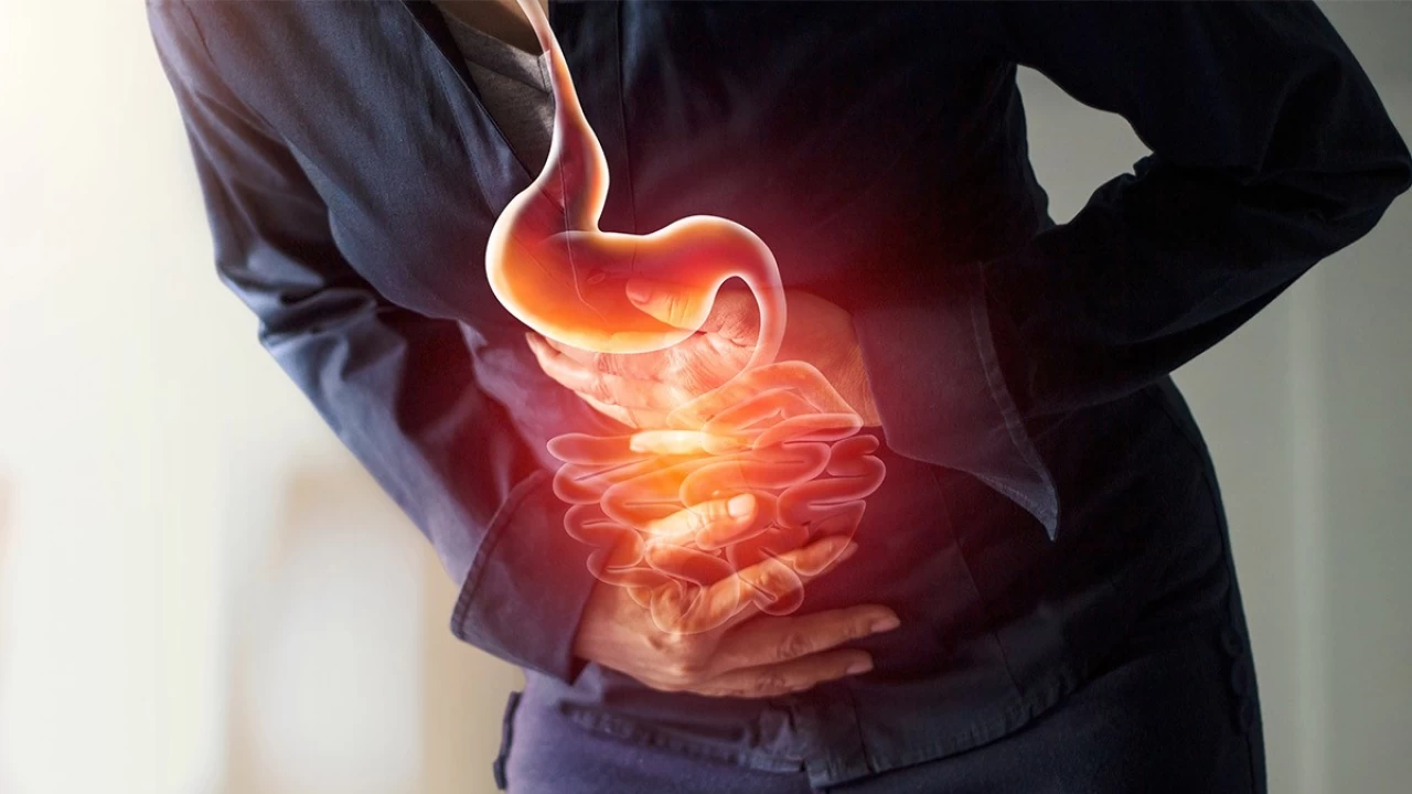 Reflü: Kronik bir sindirim sistemi rahatsızlığı