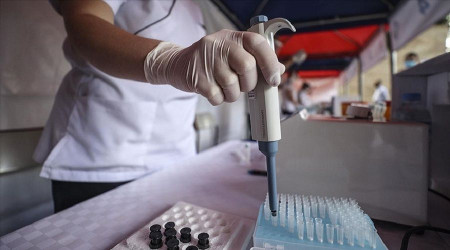 Covid-19 teşhisini 10 saniyeye düşüren yerli test kullanıma sunuldu