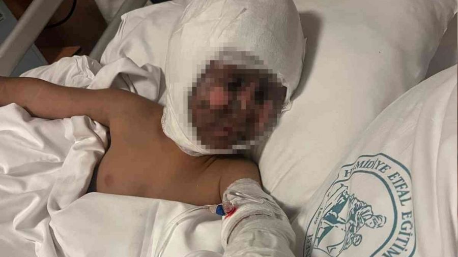 Esenyurt'ta 4 yaşındaki çocuk çatalı trafoya soktu