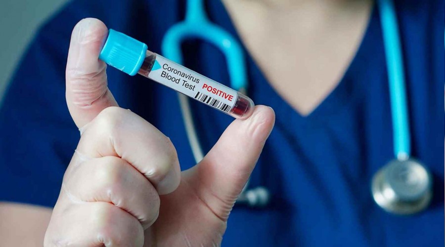 Japonya klinik çalışmalara başladı