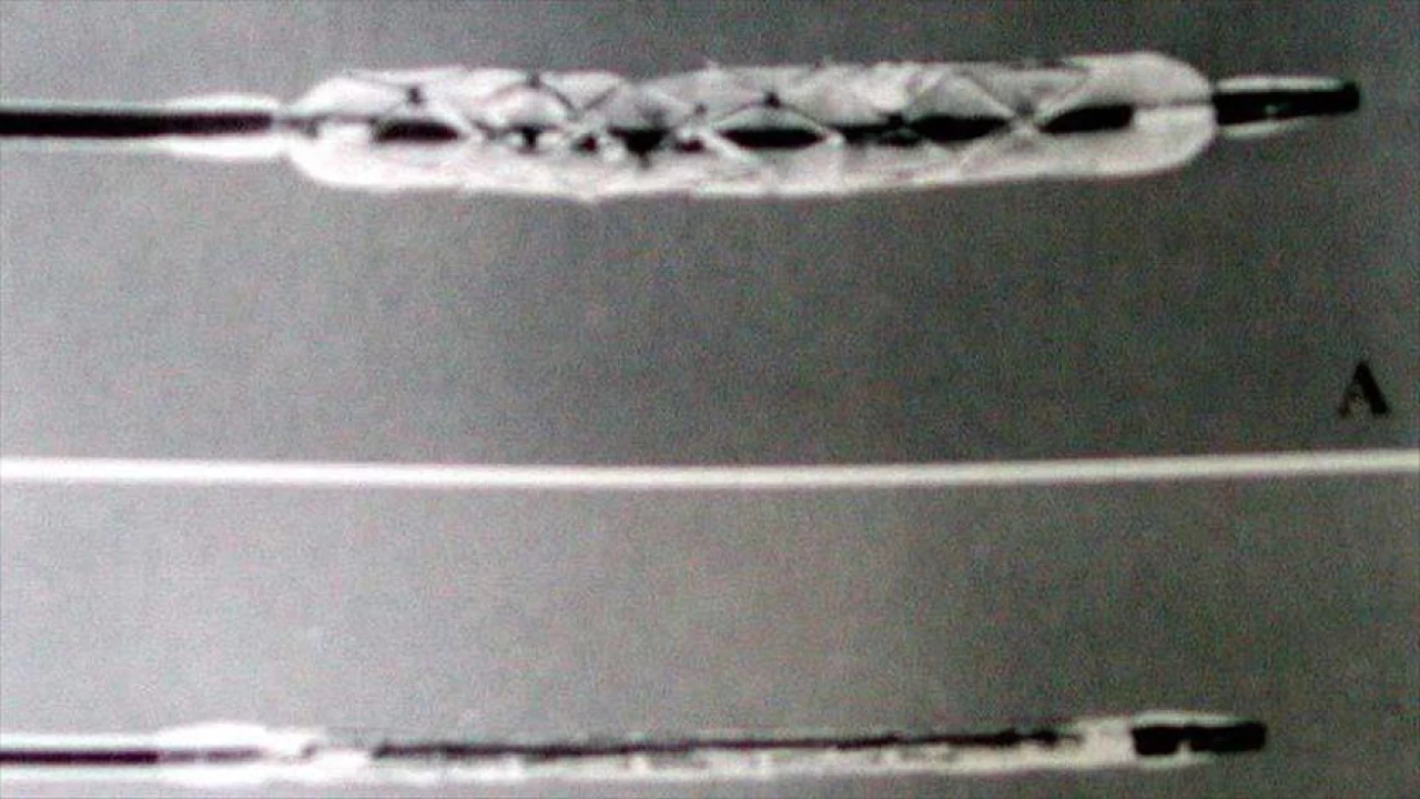 Kalp stentlerinin olumlu ve olumsuz ynleri