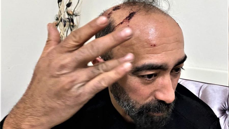 Taksiciye kaldırım taşıyla saldıran tutuklandı