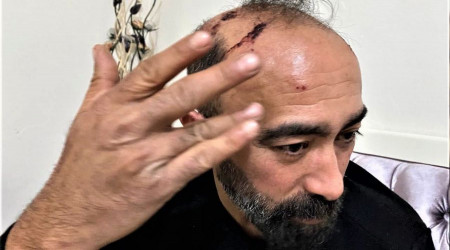 Taksiciye kaldırım taşıyla saldıran tutuklandı