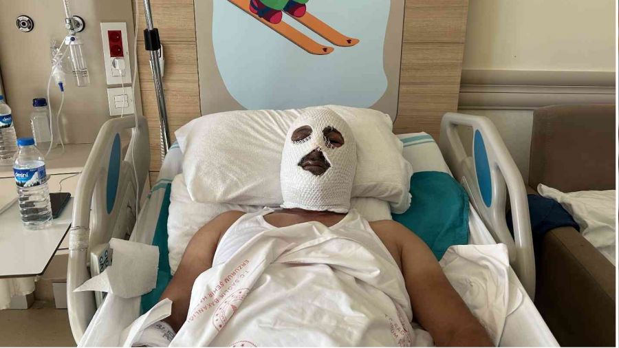 Doğal gaz borusunu tamir etmek için gitti felaketi yaşadı