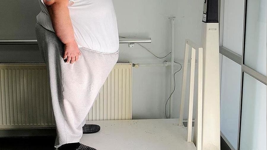 'Kriterleri tayan obezite hastalar ameliyat edilmeli'