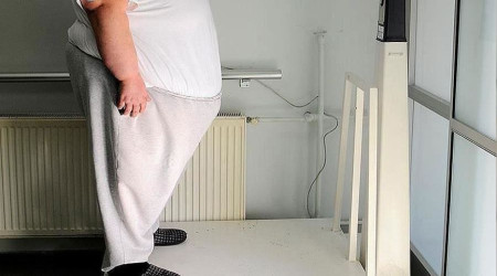 'Kriterleri tayan obezite hastalar ameliyat edilmeli'