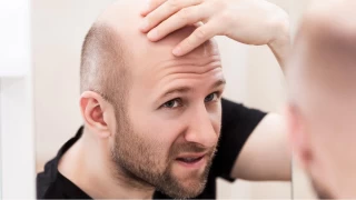 Saçlarınız İçin Alkol ve Şekerli İçecekler Tüketmeyin