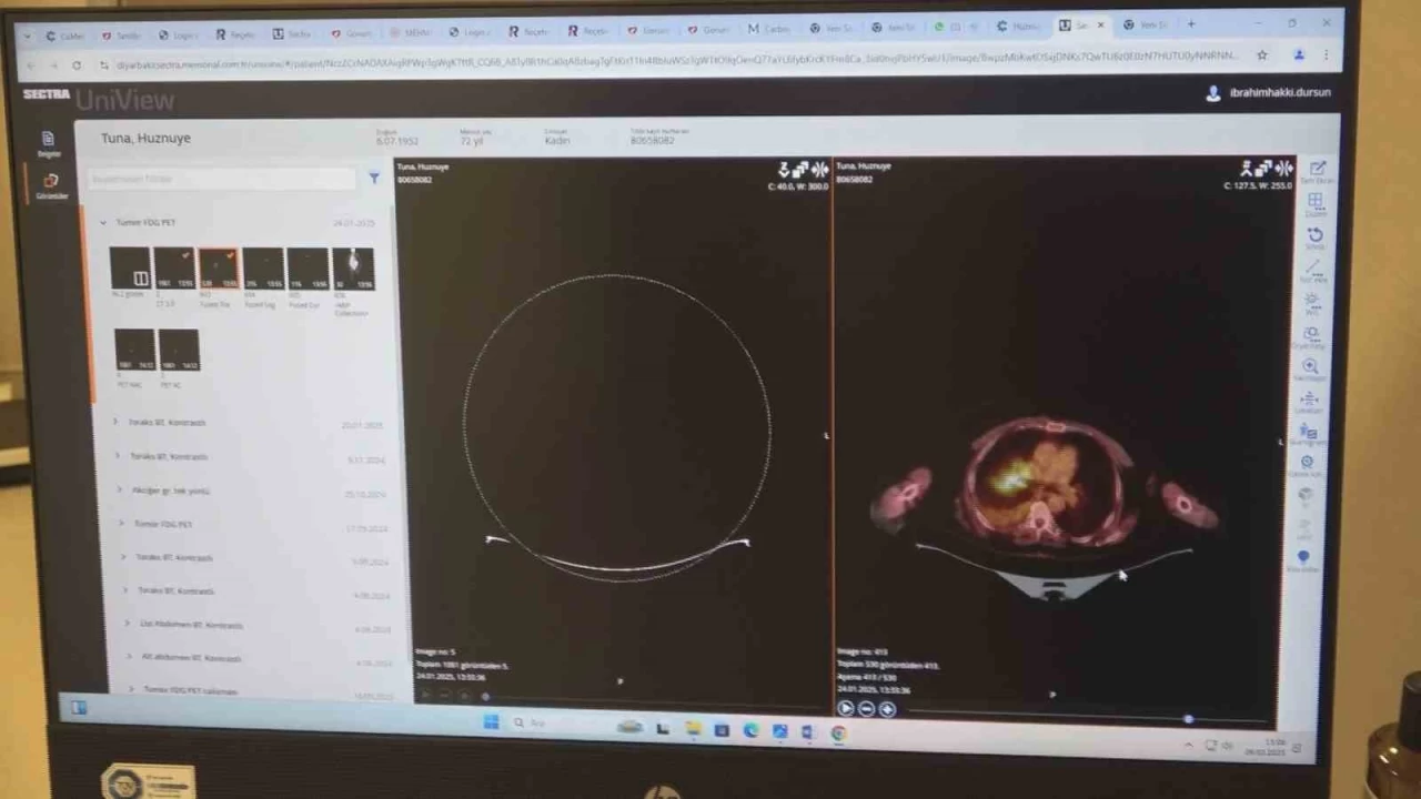 Beslenme biçimi kanser hastalığını tetikliyor