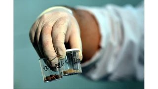    T�rkiye'de b�brek ta�� yayg�n ��nk�...