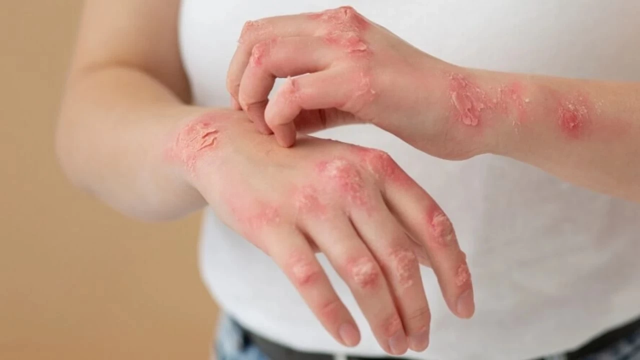 Zona hastal���: Su�i�e�i vir�s�n�n yeniden aktifle�mesi