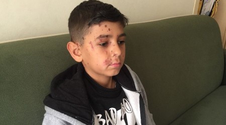 Arkadaşının attığı temizlik maddesi kör ediyordu