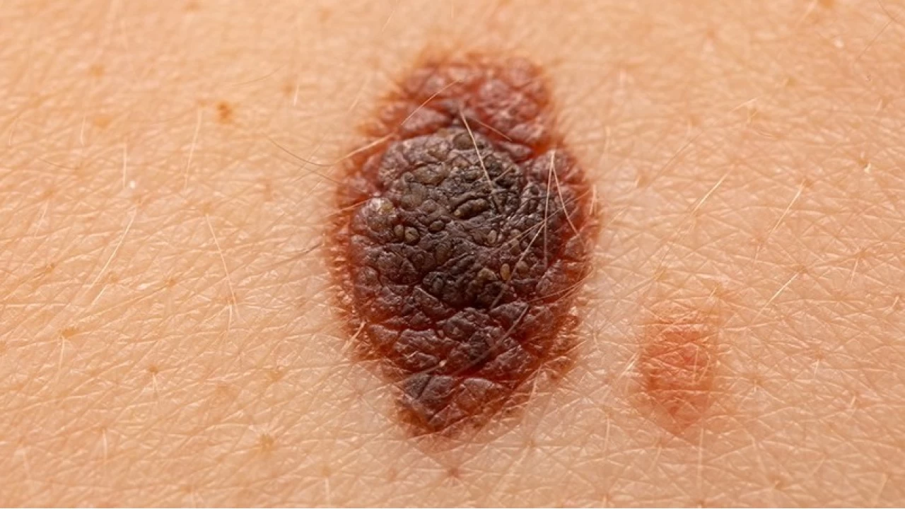 Ben kanamalar� ciddiye al�nmas� gereken bir uyar�d�r