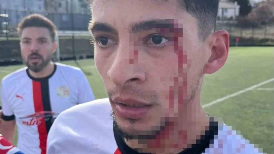 Bilecik'teki ma�ta 3 futbolcu hastanelik oldu