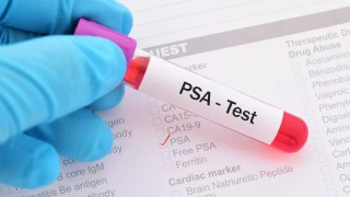 Prostat kanseri: 50 ya st erkekler dikkat!