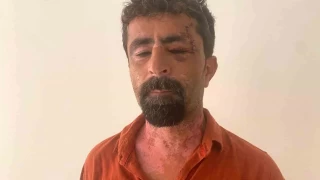 Antalya'da öfkeli damat kayınpederini hastanelik etti