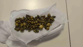 Doktorlar gözlerine inanamadı