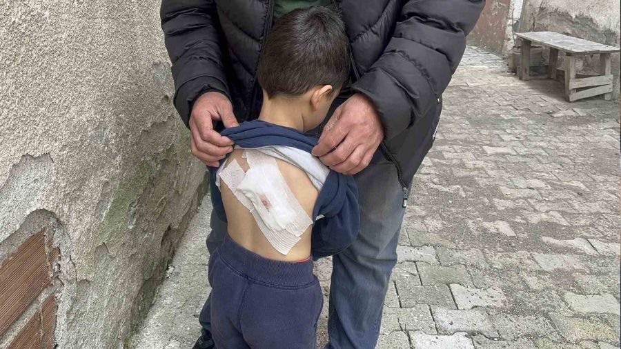 Kastamonu'da 4 yaşındaki çocuğa sokak köpekleri saldırdı